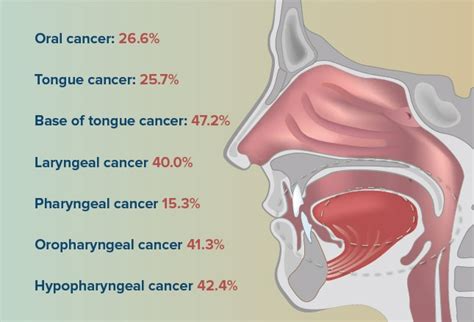 Head And Neck Cancers Risk Factors Assessment And