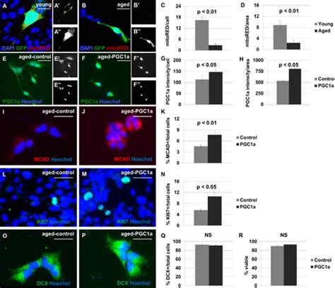 Neural Stem Cells In The Adult Subventricular Zone Oxidize Fatty Acids