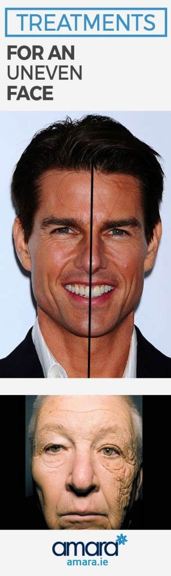 While everyone has a slightly asymmetrical face, an uneven smile may be more noticeable on some than others. Treatments For An Uneven Face & The Selfie Test!