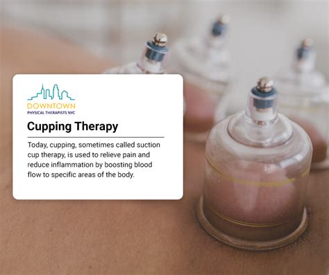 Cupping Therapy Nyc Suction Cup Physical Therapy
