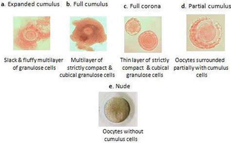 In Vitro Maturation And Fertilization Of Oocytes From Laboratory Bench
