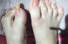 toenails