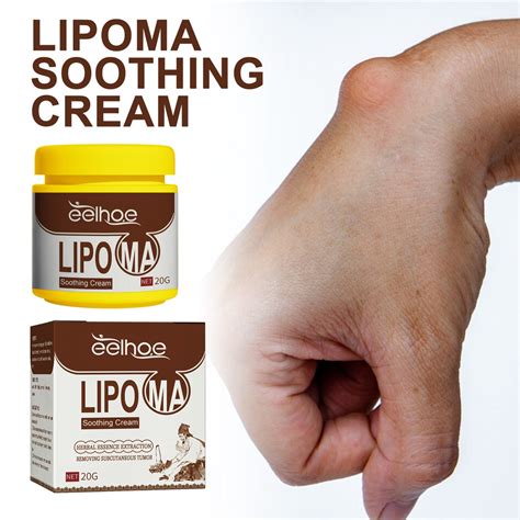 40g Lipoma Removal Cream Lipolysis Fat Lump Relief Cream Skin Swelling