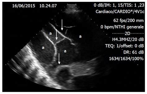 Maybe you would like to learn more about one of these? Incremental value of thoracic ultrasound in intensive care ...