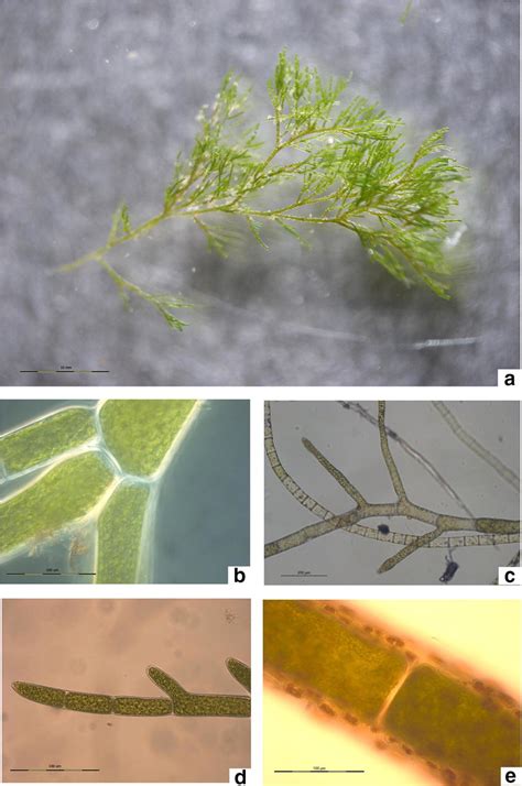 View Of The Whole Cladophora Glomerata Thalli Showing The Dense