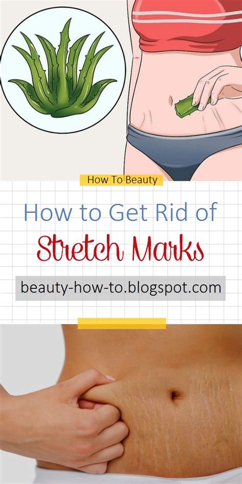 How To Get Rid Of Stretch Marks How To Beauty