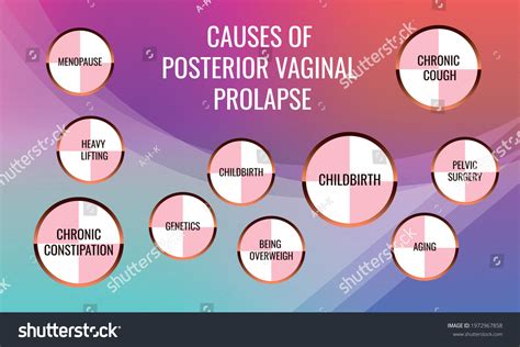 Causes Posterior Vaginal Prolapse Vector Illustration Stockvector