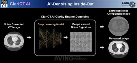 ClariPi Announces AI Based Ultra Low Dose CT Solution Claripi