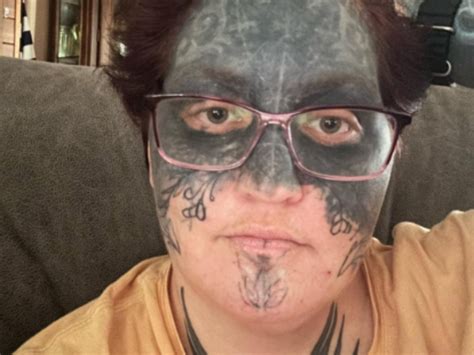 Woman With Full Face Tattoos Getting Them Removed