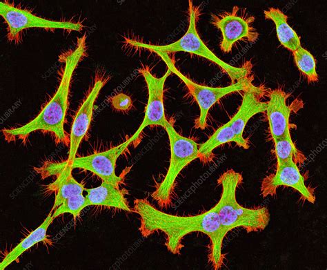 Cultured Hela Cells Light Micrograph Stock Image G4420322