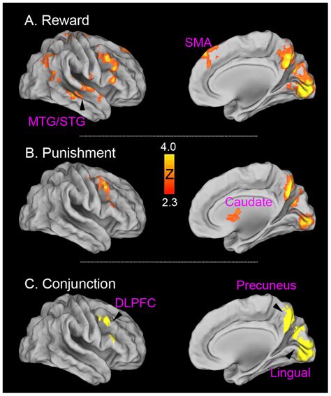 Check all that apply (you may have to check more than one figure). Brain regions associated with contingency change detection ...