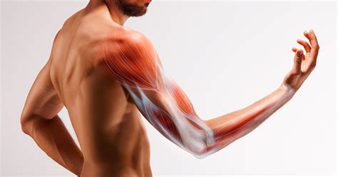 Biceps Tendon Rupture Treatment Ocala FL Dr Karl Siebuhr MD