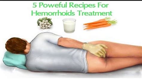 hemorrhoids home treatment relief recipes youtube