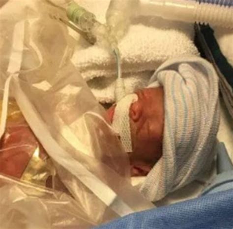 Preemie Baby Born At 24 Weeks Weighing Only 1lb Celebrates Her
