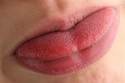Tongue Bumps 9 Types And Causes Ayur Health Tips