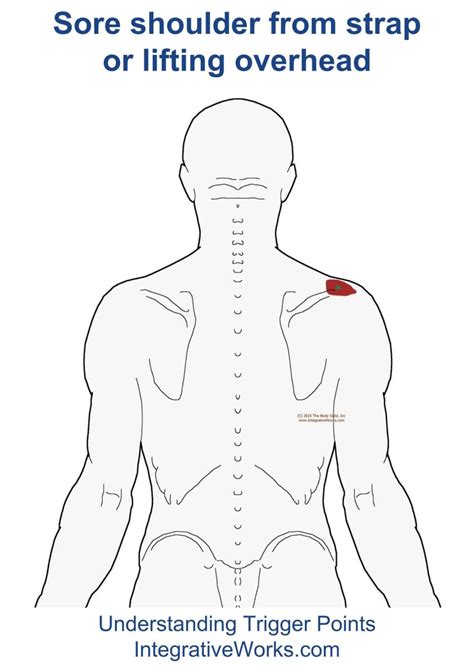 Tender Shoulder From Strap Or Overhead Lifting Integrative Works