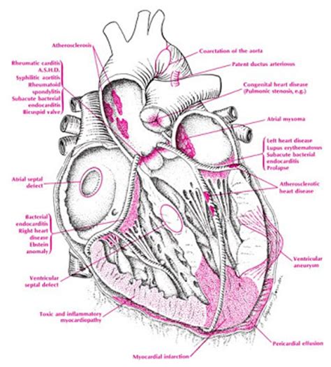 The names of the major coronary arteries are well known. devdocsof: arteries in neck diagram
