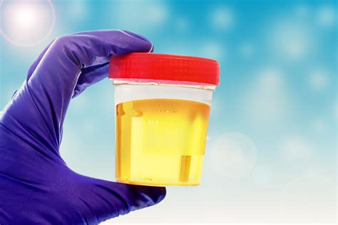 Can Cancer Cause a Chemical Smell in Urine? » Scary Symptoms