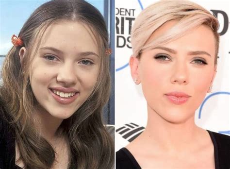 Heeft Scarlett Johansson Plastische Ingrepen Gehad Before And After