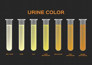 Is The Color Of Your Urine A Sign Of Dehydration Sutton Md