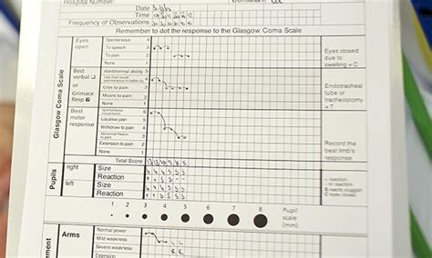 Excel Spreadsheets Help Glasgow Coma Scale Chart