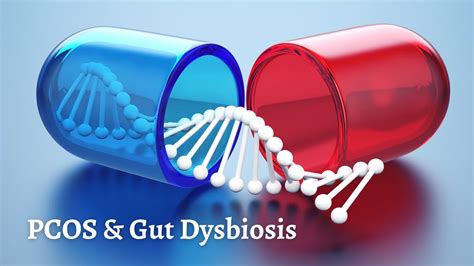 Pcos And Gut Dysbiosis Youtube