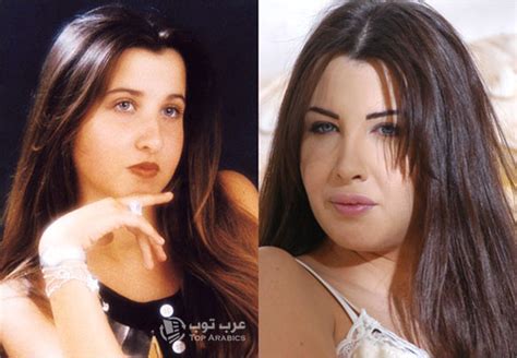 وإن كان هدف النجمات من عمليات التجميل بلوغ مرتبة عالية من الجمال والشباب الدائم، وأن يحُزن باستمرار على إعجاب جمهورهنّ، فإن الجمهور غالباً ما يلاحظ نوعاً ونعرض في هذا الألبوم مجموعة صور للعديد من النجمات اللواتي تغيرت أشكالهنّ بنسبة كبيرة جراء مبضع طبيب التجميل. صور: فنانات عربيات قبل وبعد عمليات التجميل ! | عرب توب