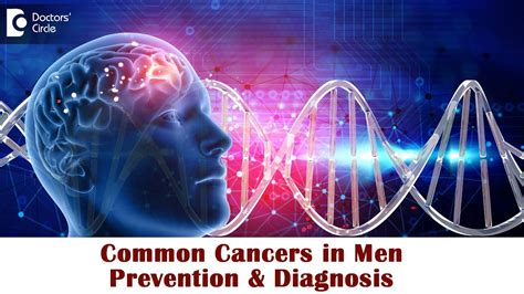 Early Prevention And Diagnosis Of Common Cancers In Men Dr Mangesh P