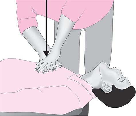 Cpr In Pregnant Woman Article Glowm
