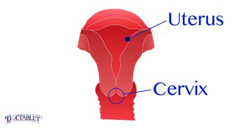 Cervix Doctablet®