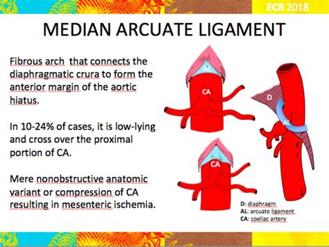 Median Arcuate Ligament When It Is Low Lying It Causes A Compression