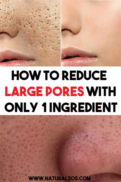How To Reduce Large Pores With Only 1 Ingredient Large Pores Reduce