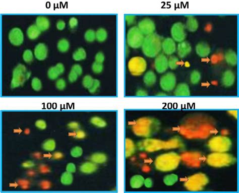 Results Of Aoeb Staining Assay Showing Normal Cells In Controls And