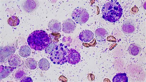 Mast Cell Tumor Cat Cytology Cat Meme Stock Pictures And Photos