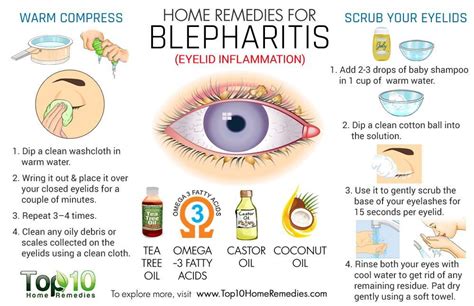 How To Get Rid Of Eye Stye How To Do Thing