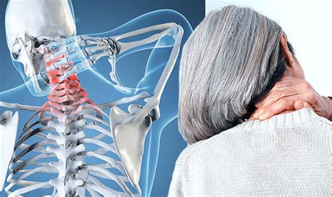This consists of a appendicular skeleton — bones of the limbs, shoulders, and pelvic girdle. Arthritis: What are the symptoms you need to look for to identify neck problems? | Express.co.uk