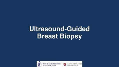 Ultrasound Guided Breast Biopsy Youtube
