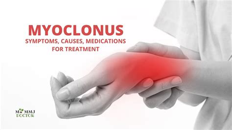 Myoclonus Symptoms Causes Types And Treatment Youtube
