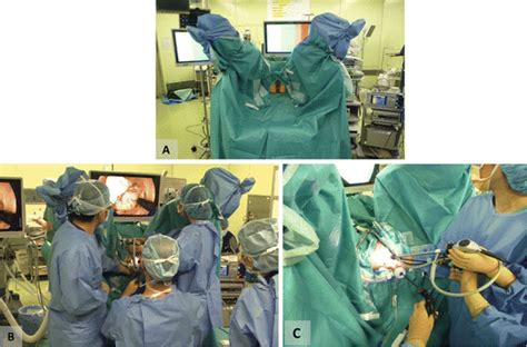 Transanal Minimally Invasive Surgery For Rectal Cancer Abdominal Key