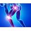 A2M Pain Treatment Joints Osteoarthritis Miraclemolecule 