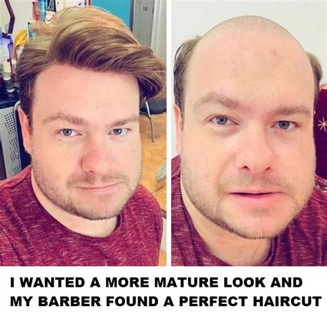 Pags Wa Haircut For Male Pattern Baldness