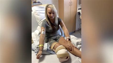 Paramedic Stays Determined After Losing Part Of Her Leg In Crash On The Job Youtube