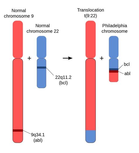 Schematic Of The Philadelphia Chromosome Philadelphia Chromosome Chromosome Dna Genetics