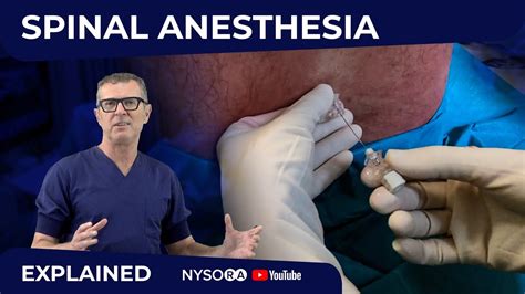 Spinal Anesthesia Explained Part 1 Crash Course With Dr Hadzic Youtube