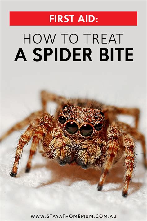 First Aid How To Treat A Spider Bite