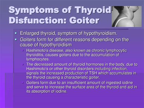 Ppt Thyroid And Anti Thyroid Drugs Powerpoint Presentation Free