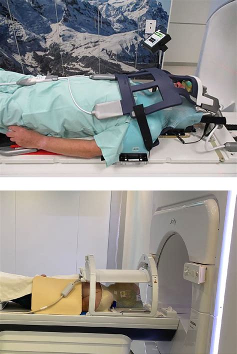 Frontiers Mr Guided Radiotherapy For Head And Neck Cancer Current
