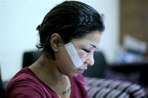 تجديد حبس المتهم بتشويه وجه فتاة المول 15 يومًا المصري اليوم