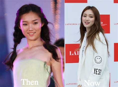 All icons were screencapped, cropped and edited by me. Lee Sung Kyung Plastic Surgery Before and After Photos ...
