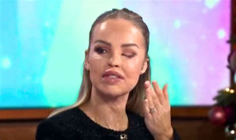Katie Piper Gives Health Update After Being Absent From Loose Women For Weeks Tv And Radio